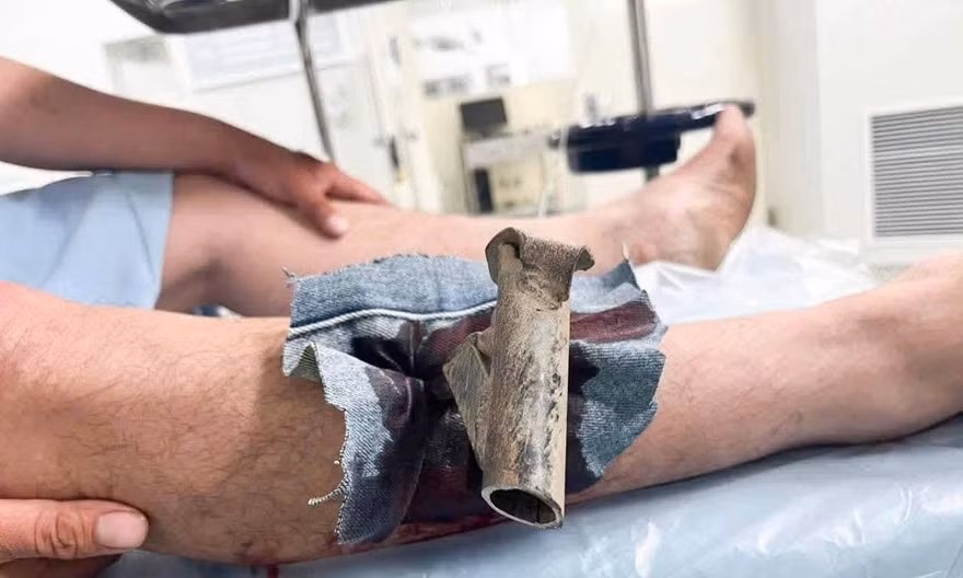 Chân chống xe máy đâm xuyên chân nam thanh niên ở Đà Nẵng