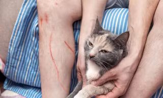 Bị mèo cào, sau 3 tháng cụ ông phát bệnh dại tử vong