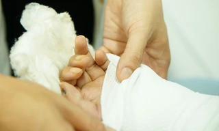 Nối thành công bàn tay của nam công nhân bị chém đứt lìa khi tăng ca đêm