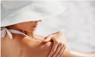Cấp cứu cho làn da bị cháy nắng khi du xuân phía Nam