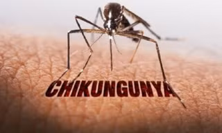 Bệnh Chikungunya đã lưu hành tại Việt Nam