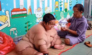 Đại dịch béo phì bùng phát, ca bệnh tăng chóng mặt tại Việt Nam