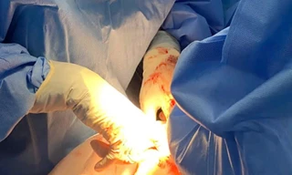 Mẹ con thai phụ lâm nguy vì bệnh nguy hiểm dễ nhầm với thai nghén