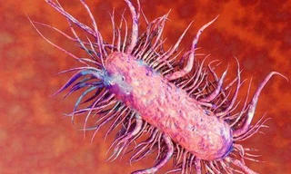 Bác sĩ Việt cứu sống bệnh nhân Campuchia bị nhiễm vi khuẩn ăn thịt người