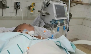 Liên tiếp 2 trường hợp viêm màng não do biến chứng zona hiếm gặp