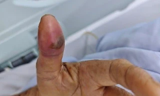 Rắn cực độc 'mai phục' trong nhà tắm cắn cụ ông nguy kịch