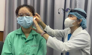 Bị vỡ xương thái dương, suýt điếc vĩnh viễn vì… ngoáy tai