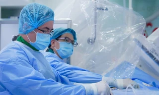 Người phụ nữ bị 'đột quỵ giả' hiếm gặp, nguy cơ tử vong cao