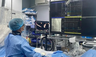 Bác sĩ dùng điện ‘đốt’ tim cứu người phụ nữ bị rối loạn nhịp