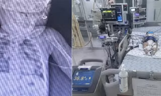 Bé gái mới biết đi bị ngã vào thùng nước khiến ngưng tim ngưng thở 