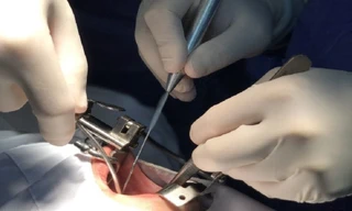 Bé trai cắn đứt rời đầu lưỡi vì rối loạn gây xu hướng tự tử ở trẻ em