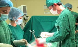 Một phụ nữ có khối u xơ tử cung lớn như bào thai 5 tháng tuổi