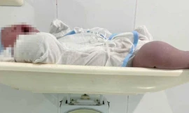 Bé trai chào đời nặng tới 5,8 kg tại Cà Mau