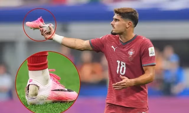Hội chứng Haglund từ Pedro Neto lan truyền trên mạng xã hội
