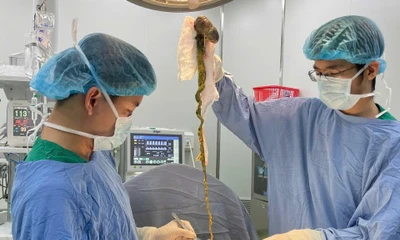 Lấy búi tóc khổng lồ ra khỏi dạ dày bé trai ở Đà Nẵng