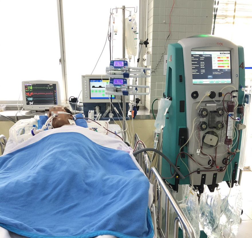 Bệnh nhân bị rắn cắn vẫn đang thở máy và lọc máu liên tục