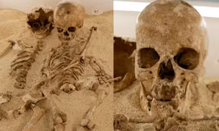 Bệnh lùn hiếm gặp bất ngờ được phát hiện từ hài cốt cách đây 12.000 năm tại Ý
