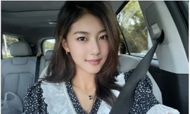 Sửng sốt trước diện mạo khác lạ sau khi 'lột xác' của 'tiểu Suzy'