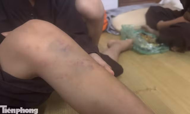 Vụ bạo hành trẻ tại chùa Bầu, Phú Thọ: Nhiều cháu có thương tích