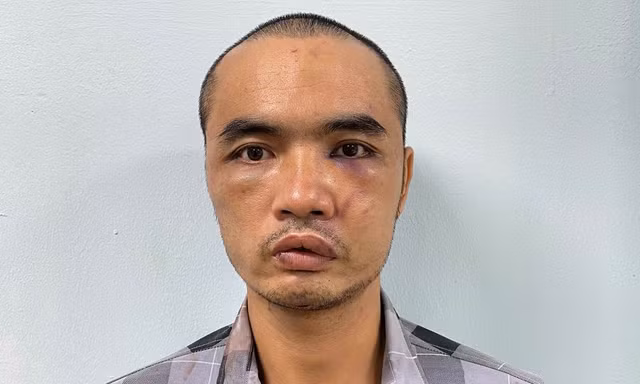 Đối tượng phá kính nhiều ô tô để ở đường Võ Chí Công khai gì?