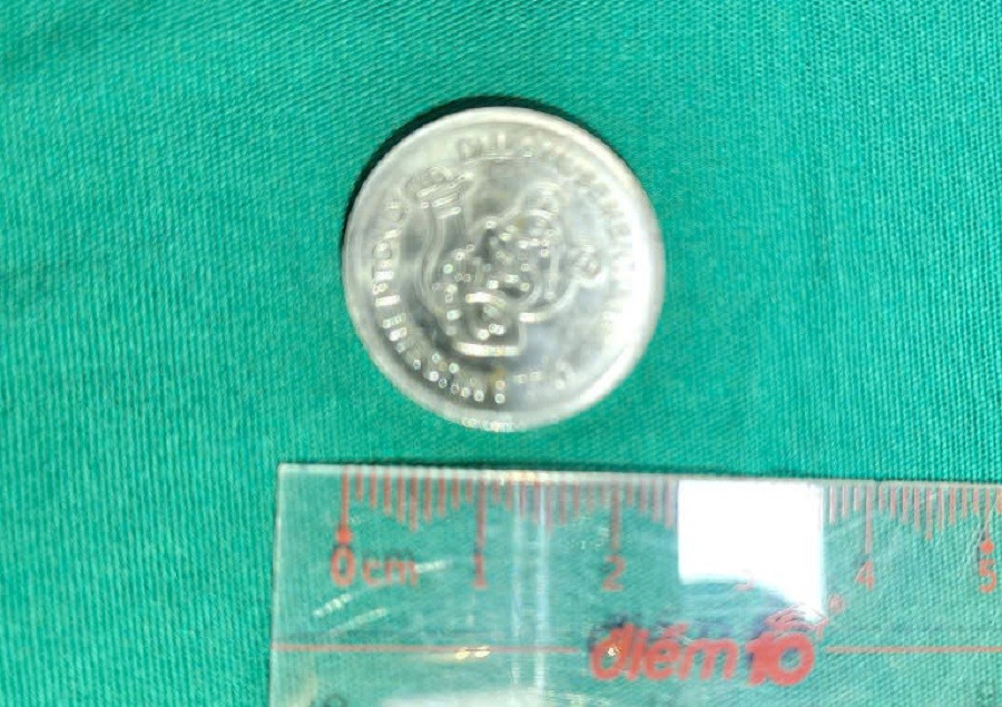hinh-anh-di-vat-dong-xu.jpg