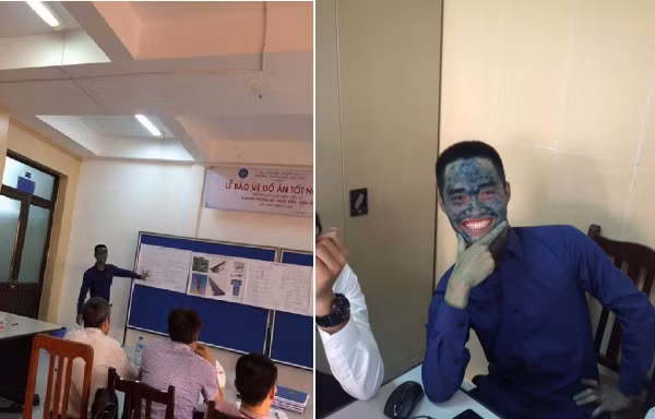 Bị thủy đậu “xanh lét" toàn thân, chàng trai này vẫn quyết tâm bảo vệ đồ án tốt nghiệp