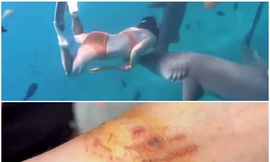 'Hot clip' một du khách Trung Quốc bị cá mập cắn khi đang lặn ở Maldives được lan truyền rộng rãi