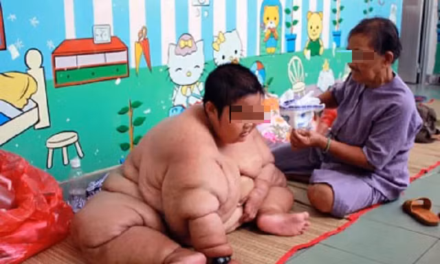 Đại dịch béo phì bùng phát, ca bệnh tăng chóng mặt tại Việt Nam