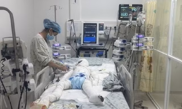 Gần 100 ngày chạy đua với 'tử thần' cứu sống bé trai bị cha phóng hỏa sau ly hôn