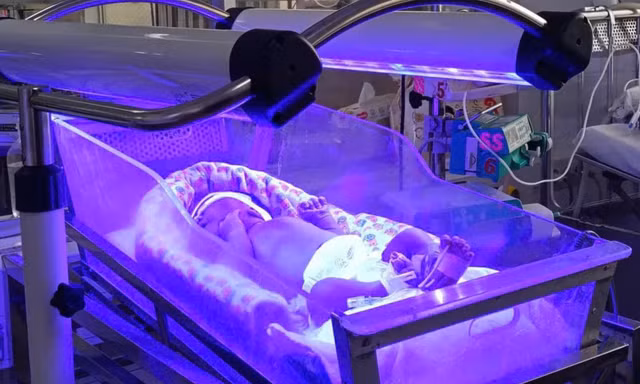 Chạy đua với ‘tử thần’ cứu bộ não cho bé sơ sinh mang nhóm máu cực hiếm