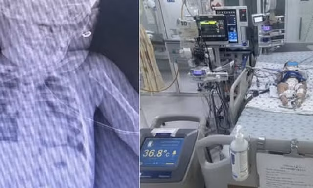 Bé gái mới biết đi bị ngã vào thùng nước khiến ngưng tim ngưng thở 
