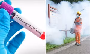 Bệnh Chikungunya từng xuất hiện ở Việt Nam: Triệu chứng, nếu mắc bệnh nên làm gì?