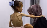 Đặc phái viên tổng thống Mỹ thăm Dải Gaza khi nạn đói hoành hành