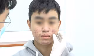 Tan nát da vì dùng mỹ phẩm 'dỏm'