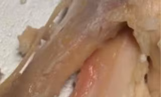 TPHCM: Phụ huynh 'tố' bữa ăn bán trú có gà chiên còn sống, thịt kho có mùi hôi