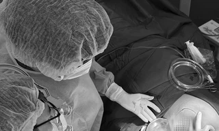 Tiêm filler làm đẹp: Tan nát mặt từ 'bác sĩ' chui