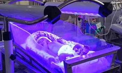 Chạy đua với ‘tử thần’ cứu bộ não cho bé sơ sinh mang nhóm máu cực hiếm