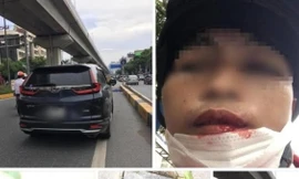 Tài xế xe ôm tố bị lái xe ô tô đấm gãy răng vì... không cho vượt