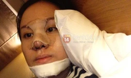 Bà Tưng lộ ảnh hậu dao kéo