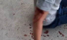 Xác minh vụ chó cắn du khách nước ngoài nhập viện tại Nha Trang