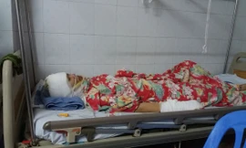 Chị Huyền hiện đang được điều trị tại Viện bỏng quốc gia và đã qua cơn nguy kịch