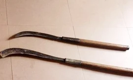 Em vợ bị anh cầm rựa chém tới tấp khi đang ngủ