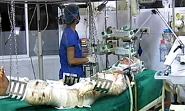 Một chiến sĩ bị thương trong vụ máy bay Mi 171 rơi đang điều trị tại Viện bỏng quốc gia. Ảnh: D. Thu (Báo Người Lao Động)