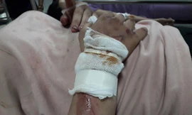 Lời kể của nữ sinh bị giật điện thoại, kéo lê 20 mét