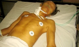 Ông Phạm Văn Bảy đang cấp cứu tại Bệnh viện đa khoa tỉnh Bình Phước