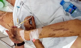 Võ Duy Nghiêm bị tạt axit, cắt gân chân khi về quê ăn tết