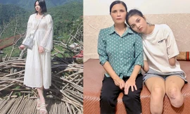 Cô gái Phú Thọ mất tứ chi trong một tháng, được mẹ chăm như trẻ sơ sinh