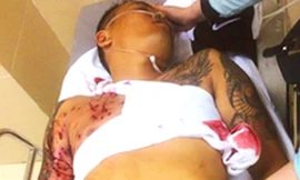 Nạn nhân lúc được đưa đi cấp cứu