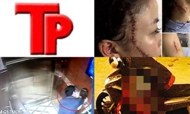 Bản tin Hình sự: Vi sao cô gái 18 tuổi bị bạn rạch mặt, khâu 60 mũi?