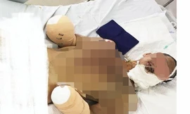 Hiện sức khoẻ bệnh nhân đã ổn định, tuy nhiên vụ pháo nổ đã để lại di chứng nặng nề